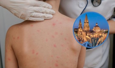 Sarampión en Jalisco muestra las entrañas de un capitalismo voraz